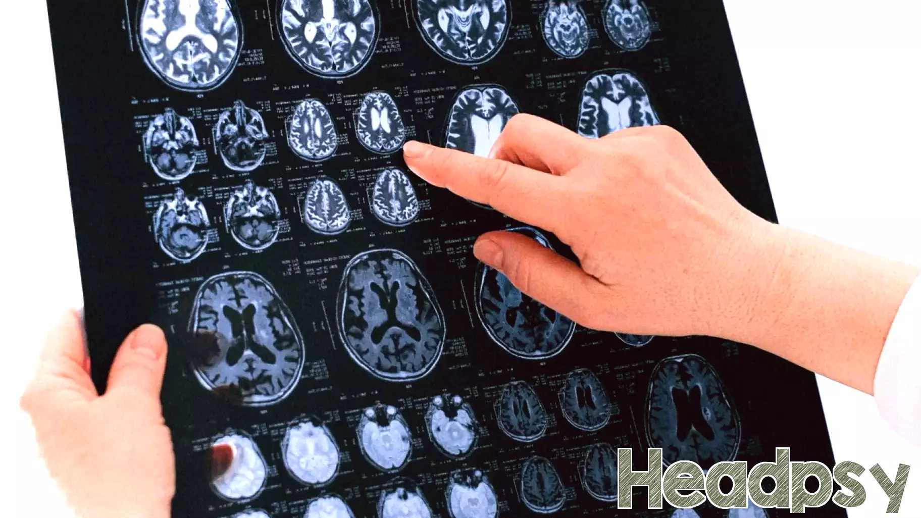 Let's Ask Brains What ADHD Looks Like