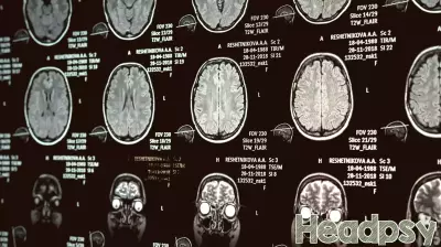 Narcissistic traits are linked to a brain area governing emotional control